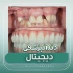 دندانپزشکی دیجیتال در تهران