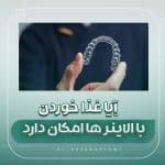 غذا خوردن با الاینر : توصیههای ما برای الاینر