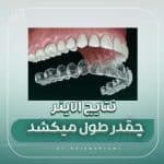 چه مدت طول میکشد تا الاینر نتیجه بدهد؟