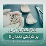 کاربرد نانوتکنولوژی در پر کردن دندان های حساس چیست ؟
