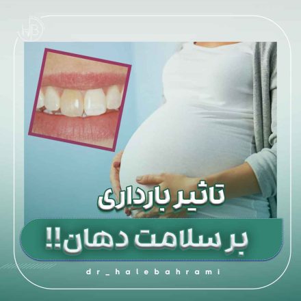 آیا سلامت روان مادر و استرس بارداری میتواند بر سلامت دهان او تأثیر بگذارد؟