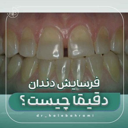 آیا جایگزین سالمتری برای نوشیدنیهای انرژیزا وجود دارد؟