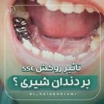 تأثیر استفاده از روکشهای استنلس استیل (SSC) بر سلامت لثه در دندانهای شیری چیست؟