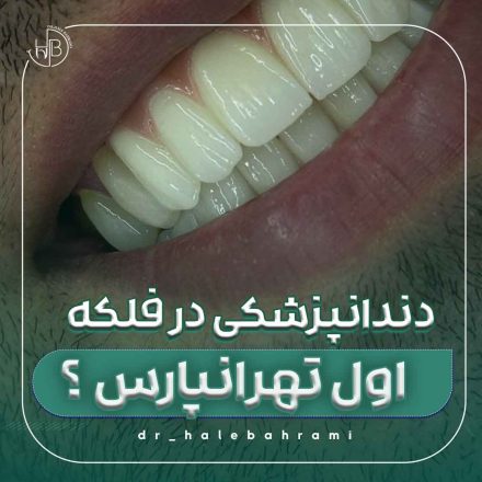 در ازدحام تهرانپارس، چگونه میتوان مرکزی برای سلامت دندان یافت که هم معتبر باشد و هم در دسترس؟