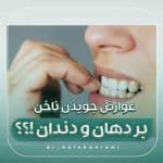 عادت ناخن جویدن و عوارض دهانی و دندانی