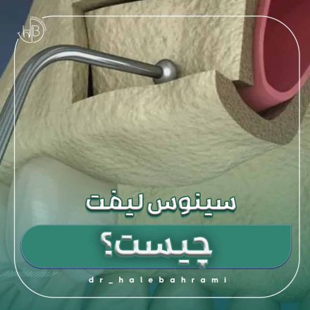پس از جراحی چگونه باید بهداشت دهان را رعایت کنم؟