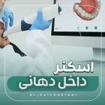 معرفی اسکنر داخل دهانی: خداحافظی با خمیر قالبگیری!