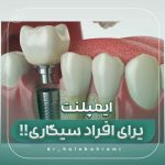 اگر سیگاری هستم، آیا میتوانم ایمپلنت دندان انجام دهم؟