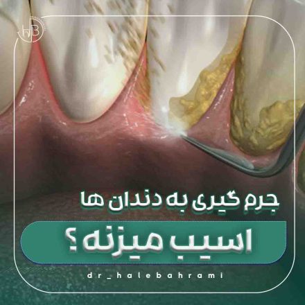 اگر جرمگیری نکنم چه اتفاقی میافتد؟