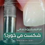 آیا ایمپلنت دندانی ممکن است شکست بخورد یا بدن آن را پس بزند؟