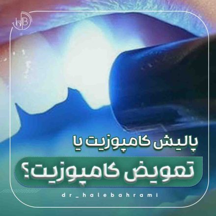 از نظر هزینه، پالیش و تعویض چقدر تفاوت دارند؟