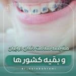 مقایسه سلامت دندان در ایران و کشورهای پیشرفته